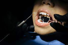 Ini 4 Perawatan Gigi untuk Anak dan Remaja