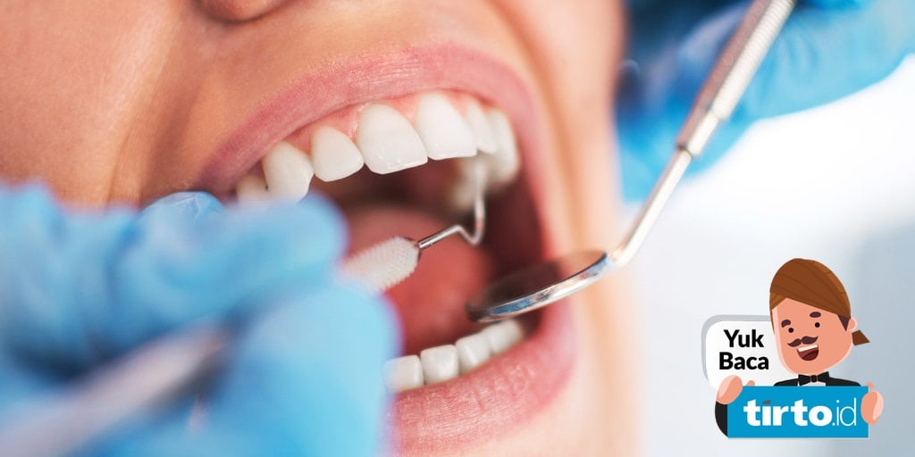 8 Jenis Perawatan untuk Kerusakan Gigi, Implan
